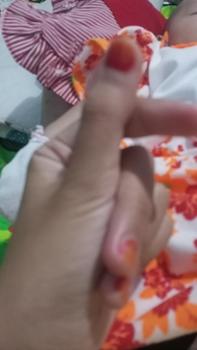 Product Review of CREAM TOTOL CABERAWIT (JERAWAT,FLEK,BEKAS JERAWAT) from A**a 0