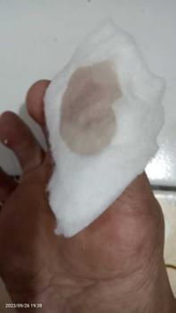 Product Review of tumitku obat kaki Kapalan from F**a f**t 1
