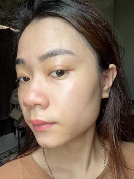 Product Review of [Mã 3] Mua 1 Tặng 1, ACNE SERUM - Serum Diếp Cá 5ml Hỗ Trợ Cải Thiện Mụn - Thương Hiệu: LE'PEAU from H**️ 2