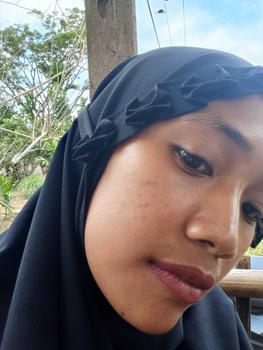 Product Review of FYC [Punya Dania] - 5IN1/6IN1/7IN1 Nuface Paket Perawatan Mencerahkan Wajah / Perawatan Jerawat / Anti Penuaan Skincare Set  Pencerah  Muka from M**s 2