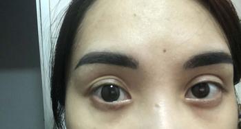 Product Review of [Gerda Gray] có cận đến 6.5 - Lens Kính áp tròng - 1 CHIẾC lens Hàn - Kính áp tròng cận from D**n 0