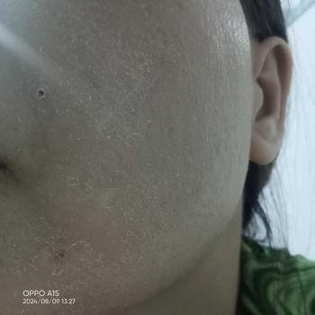 Product Review of Combo kem tái tạo da trị mụn thâm dưỡng trắng da kèm bông gòn (dành cho da khoẻ) from L** D**g ❤** 0