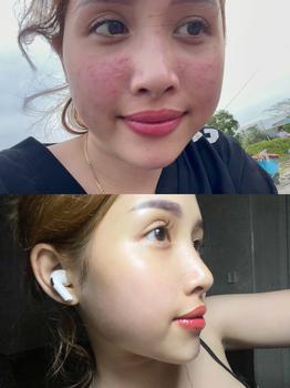 Product Review of KOL - Combo 10 Mặt Nạ Hỗ Trợ Dưỡng Da SUR.MEDIC Mask 30g/miếng from n**y 2