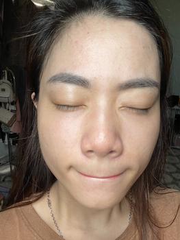 Product Review of [Mã 3] Mua 1 Tặng 1, ACNE SERUM - Serum Diếp Cá 5ml Hỗ Trợ Cải Thiện Mụn - Thương Hiệu: LE'PEAU from H**️ 0