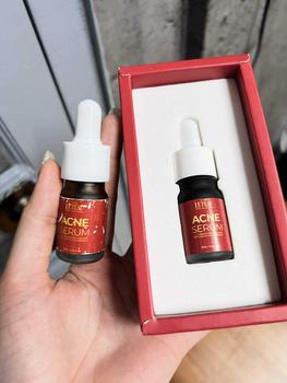 Product Review of [Mã 3] Mua 1 Tặng 1, ACNE SERUM - Serum Diếp Cá 5ml Hỗ Trợ Cải Thiện Mụn - Thương Hiệu: LE'PEAU from N**n T** L** A** 0