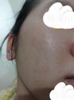 Product Review of Tinh Chất B512 Repair Hydrating Booster Bioverse Hỗ Trợ Làm Diụ, Giảm Kích Ứng Và Cải Thiện Độ Ẩm Cho Da 30ml [TẶNG Serum B351 5ml TẶNG THÊM ĐƠN 399K Serum C102 5ml TỪ 01-06.5] from _**_ 1