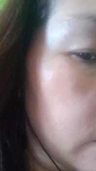 Product Review of Melasma Cream Pekas Remover Yunnan Herbal Effective Whitening Freckle Cream Original High from D**a 3