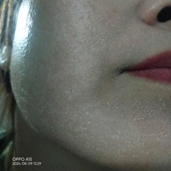 Product Review of Combo kem tái tạo da trị mụn thâm dưỡng trắng da kèm bông gòn (dành cho da khoẻ) from L** D**g ❤** 1