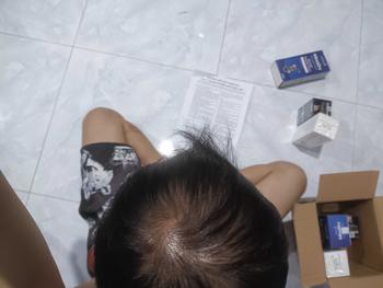 Product Review of Combo Mọc Tóc MinoDry 5% Dạng Lỏng (MinoDry Minoxidil 5% + DHT Blocker + Lăn Kim 0.5mm) from H** N** 3