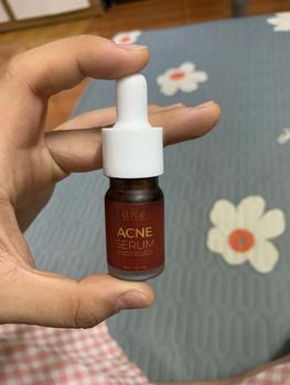 Product Review of [Mã 3] Mua 1 Tặng 1, ACNE SERUM - Serum Diếp Cá 5ml Hỗ Trợ Cải Thiện Mụn - Thương Hiệu: LE'PEAU from A** 2
