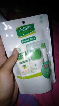 Product Review of NEW Acnes Starter Pack Acnes Treatment Series 3 Items from z**y 0