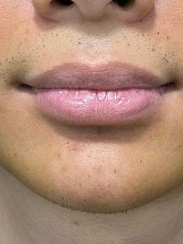 Product Review of Son Dưỡng, Ủ Môi Lựu Đỏ, Collagen Lip Mask, Hỗ Trợ Giảm Thâm, Hồng Môi, Dưỡng Ẩm - HAILA3 from H**g 0