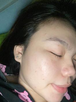 Product Review of [Mã 3] Mua 1 Tặng 1, ACNE SERUM - Serum Diếp Cá 5ml Hỗ Trợ Cải Thiện Mụn - Thương Hiệu: LE'PEAU from H**g t** 1