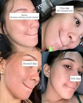Product Review of SEVENDAYS POWER SUN PROTECT SUNSCREEN SPF40 BY HERSKIN Sunscreen Skincare SPF40+ PA+++ Lightweight Non-greasy Fast-absorbing Matte Hydrating Brightening Anti-aging UV protection Everyday use Safe Gentle Water-resistant Cruelty-free Travel-size Affordable from J**o 0