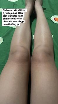 Product Review of Combo 2Hủ x120g Kem Body Cốt Ủ Siêu Tẩy Mạnh Dành Cho Da Ngâm Đen Chai Lì Làm Đẹp Da Nữ Dưỡng  Da Body from B** N**👑 3