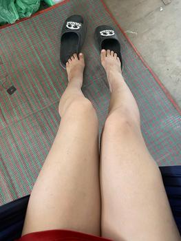 Product Review of ครีมอีผ่อง กล่องดำ 1 กล่องมีครีม2กระปุกกับสบู่ 1 ก้อน สกินแคร์ from 💙** 1