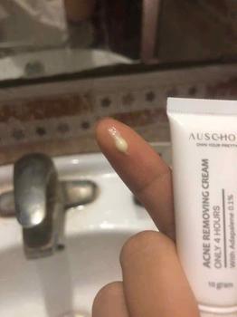 Product Review of Kem chấm mụn, gom cồi 4h AUSCHOO Acne Removing Cream 10g Adapalene 0.1% Làm Đẹp Da Skincare Chăm Sóc Da Giảm Thâm Giảm Mụn Cho Da Mụn from t**6 2