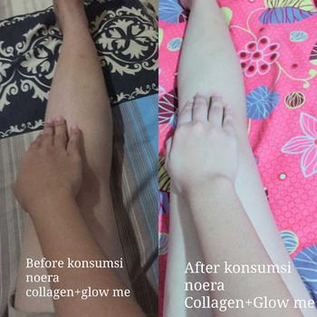 Product Review of Noera Glow Me Skin Capsule | Suplemen Kecantikan Kulit | Perawatan Kulit from A**_ 1