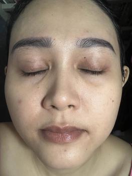 Product Review of Serum Dày Da New Skin Lady -  Phục Hồi Da Mỏng Yếu - B5 Phục Hồi Da Size 35ml from n**g 1
