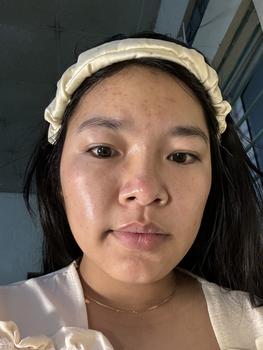 Product Review of Combo 3 Hộp Nước Uống Pure White Hỗ Trợ Trắng Da Nhật Bản (1 Hộp 10 Chai x 50ml) from K**️ 0