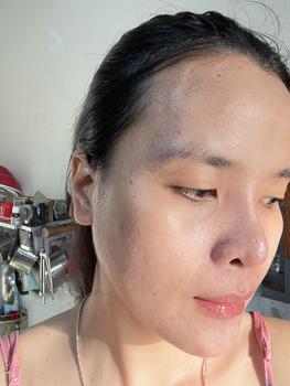 Product Review of KEM MỤN BUSTER 20G - Kim Mỹ Kim - Kem Hỗ Trợ Da Mụn - Net 20g Chăm Sóc Da Skincare Làm Đẹp Da Nữ Dưỡng Ẩm Da from N** N** 3