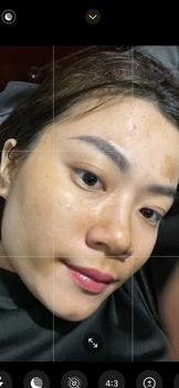 Product Review of [Mã 3] Mua 1 Tặng 1, ACNE SERUM - Serum Diếp Cá 5ml Hỗ Trợ Cải Thiện Mụn - Thương Hiệu: LE'PEAU from H** p**g c** T** T**g ❤**️ 3