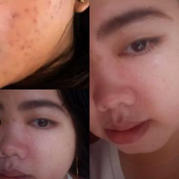 Product Review of Noera Glow Me Skin Capsule | Suplemen Kecantikan Kulit | Perawatan Kulit from A**_ 2