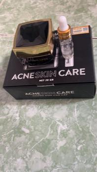 Product Review of KEM HỖ TRỢ GIẢM MỤN - Thương hiệu SOOYOUNG 20gr from C**è 3