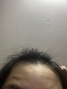 Product Review of Tẩy Tế Bào Chết Da Đầu All About Hair 200gr - Chăm Sóc Tóc, Dưỡng Tóc ( Tặng Xịt Biotin 50ml) from N** Đ** Đ** T** Đ** T** 1
