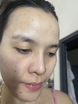 Product Review of KEM MỤN BUSTER 20G - Kim Mỹ Kim - Kem Hỗ Trợ Da Mụn - Net 20g Chăm Sóc Da Skincare Làm Đẹp Da Nữ Dưỡng Ẩm Da from N** N** 2