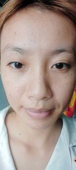 Product Review of [Mã 3] Mua 1 Tặng 1, ACNE SERUM - Serum Diếp Cá 5ml Hỗ Trợ Cải Thiện Mụn - Thương Hiệu: LE'PEAU from K** n**n 2