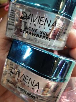 Product Review of DAVIENA SKINCARE NIGHT CREAM | ACNE SERIES | GLOWING SERIES | GOLD SERIES | DAVIENASKINCARE | DAVIENA SKINCARE OFFICIAL | DAVIENA SKINCARE OFFICIAL STORE | DAVIENA SKINCARE ORI | DAVIENA SKINCARE ORIGINAL | DAVIENA SKINCARE PUSAT from a**9 0