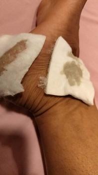 Product Review of tumitku obat kaki Kapalan from a**r 0