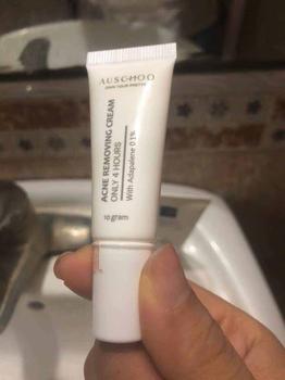 Product Review of Kem chấm mụn, gom cồi 4h AUSCHOO Acne Removing Cream 10g Adapalene 0.1% Làm Đẹp Da Skincare Chăm Sóc Da Giảm Thâm Giảm Mụn Cho Da Mụn from t**6 1