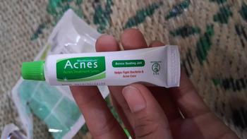 Product Review of NEW Acnes Starter Pack Acnes Treatment Series 3 Items from t**🌻 3