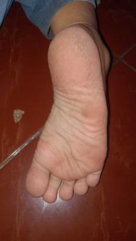 Product Review of tumitku obat kaki Kapalan from Y**a 0