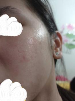 Product Review of Tinh Chất B512 Repair Hydrating Booster Bioverse Hỗ Trợ Làm Diụ, Giảm Kích Ứng Và Cải Thiện Độ Ẩm Cho Da 30ml [TẶNG Serum B351 5ml TẶNG THÊM ĐƠN 399K Serum C102 5ml TỪ 01-06.5] from _**_ 0