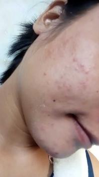 Product Review of Queenwhite Rejuvenating set All Skin Types from R**N 0