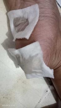 Product Review of tumitku obat kaki Kapalan from F**a f**t 2