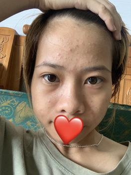 Product Review of nước tái tạo da thảo dược sắc mộc lan Làm Đẹp Da from L**🖤 1