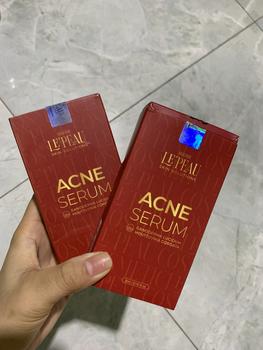 Product Review of [Mã 3] Mua 1 Tặng 1, ACNE SERUM - Serum Diếp Cá 5ml Hỗ Trợ Cải Thiện Mụn - Thương Hiệu: LE'PEAU from T**o ** 1
