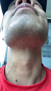 Product Review of Dung dịch Minoxidil 5% Kirkland hỗ trợ mọc râu (1 Chai 60ml + LCLT) Chăm Sóc Tóc Dưỡng Tóc dầu gội kich moc from d**đ 0