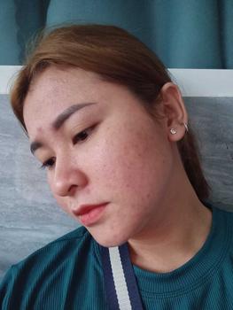 Product Review of Combo Gel Chấm Mụn, Kem Dưỡng Ẩm The Cafuné Dành Cho Da Mụn 120gram Skincare Chăm Sóc Da from N**n T**h 1** 3