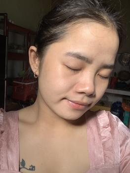 Product Review of [Mã 3] Mua 1 Tặng 1, ACNE SERUM - Serum Diếp Cá 5ml Hỗ Trợ Cải Thiện Mụn - Thương Hiệu: LE'PEAU from T**o ** 2