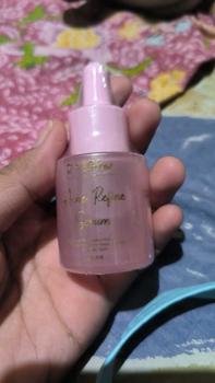 Product Review of Jglow Skincare Acne Refine Serum Refiing Untuk kulit Berjerawat dan Kulit kusam 20 ML from p**9 0