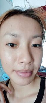 Product Review of [Mã 3] Mua 1 Tặng 1, ACNE SERUM - Serum Diếp Cá 5ml Hỗ Trợ Cải Thiện Mụn - Thương Hiệu: LE'PEAU from K** n**n 2