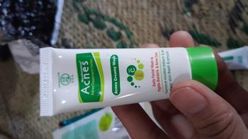 Product Review of NEW Acnes Starter Pack Acnes Treatment Series 3 Items from t**🌻 1