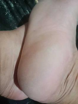 Product Review of JC Callus Remover for Damaged and Cracked Heel With Wooden Foot File Eucalyptus Scented At Home Foot Spa Session Soft  Moisturizer Dry Skin Oil Peeling Nails Moisture Hydrate Hydrating from h**e ** s**p 3