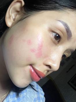 Product Review of KOL - Combo 10 Mặt Nạ Hỗ Trợ Dưỡng Da SUR.MEDIC Mask 30g/miếng from n**y 1