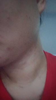 Product Review of KEM HỖ TRỢ GIẢM MỤN - Thương hiệu SOOYOUNG 20gr from N**g N**n 1